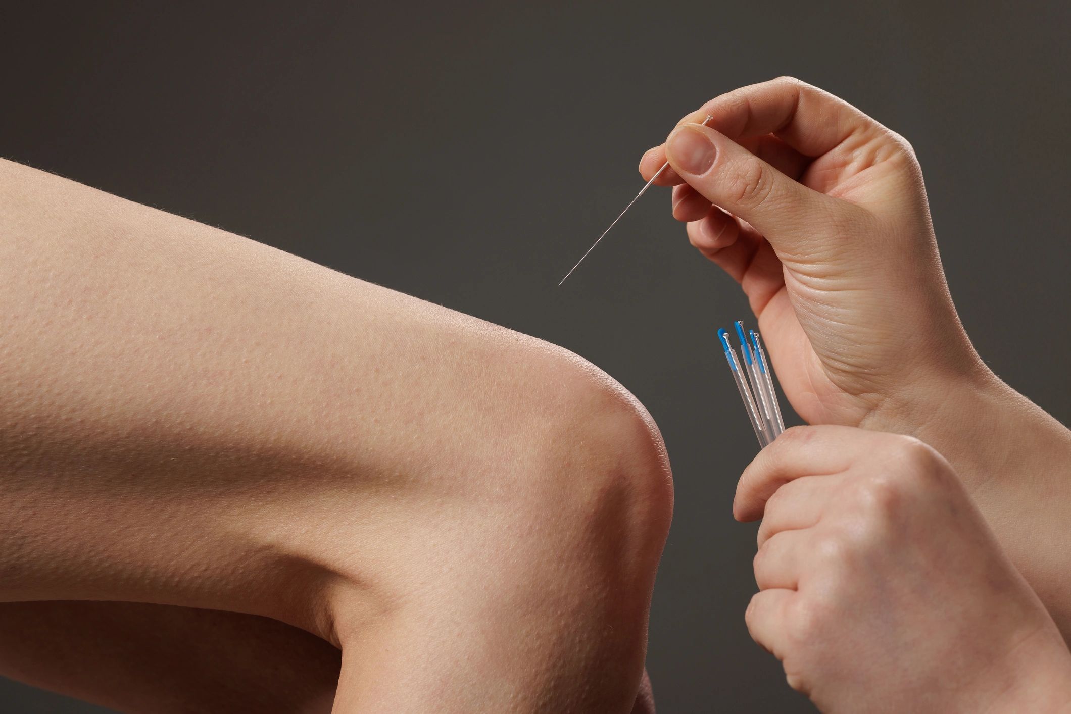 Dry needling technique close-up